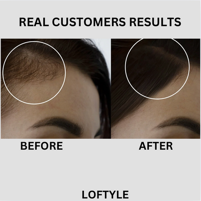 PEPTIDE HAIR GROWTH SERUM