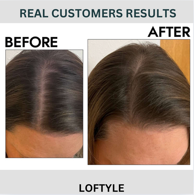 PEPTIDE HAIR GROWTH SERUM
